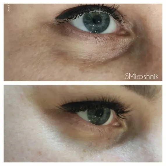 Стерильный концентрат, биорепарант Estefarm, COLLAPRO collagen 45+, 5ml