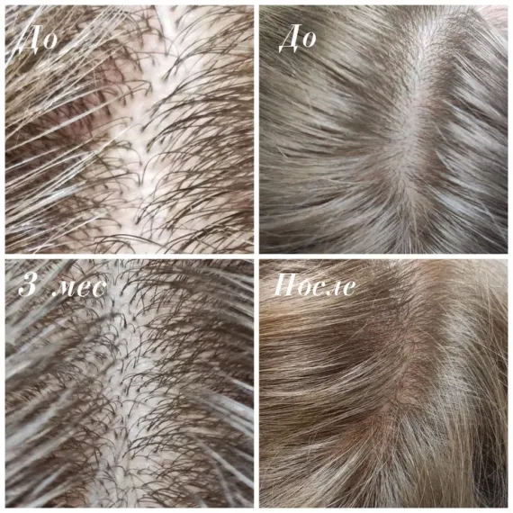 Универсальный препарат для лечения волос ESTEFARM, Este HAIR, 3ml