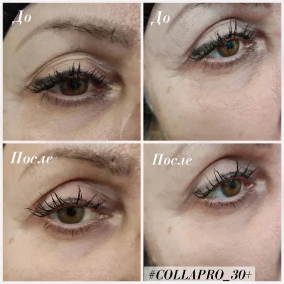 Стерильный концентрат  Estefarm, COLLAPRO collagen 30+, 5ml