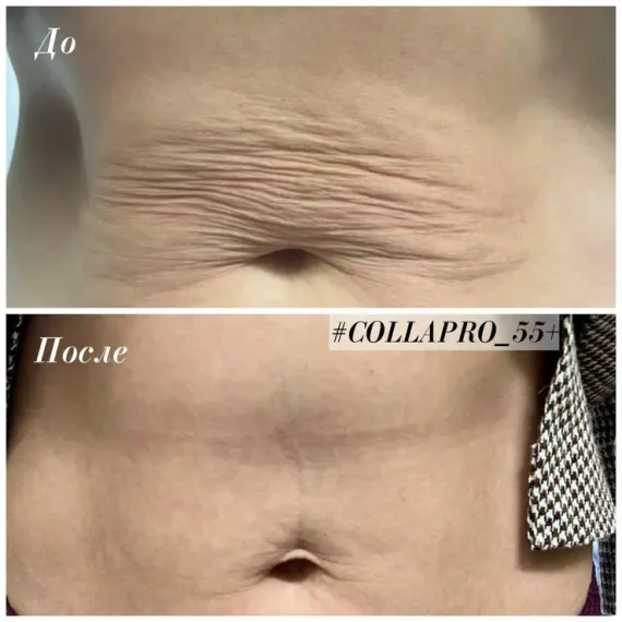 Стерильный концентрат, биорепарант Estefarm, COLLAPRO collagen 55+, 5ml